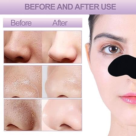 8 Pc's Nose Strips Blackhead Remover & Pore Cleanser Skincare Cleansing Charcoal for Women and man (pack of 8)