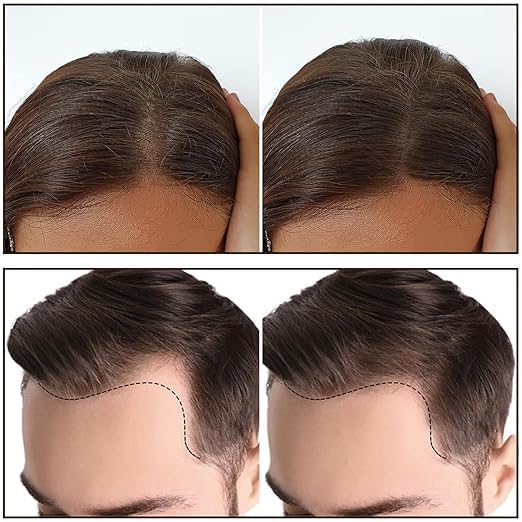 Hairline Powder Stick Hair Shadow Powder Root Touch Up Powder Waterproof Hair Shading Sponge Pen Hair Filler Powder for Cover Gray Hair Root, Hair Touch-Up Thin Hair Eyebrow Stamp